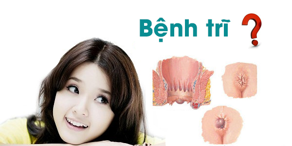benh-tri-la-gi.jpg