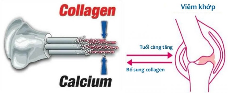 Collagen có thật sự hiệu quả trong việc bảo vệ xương khớp-1.jpg