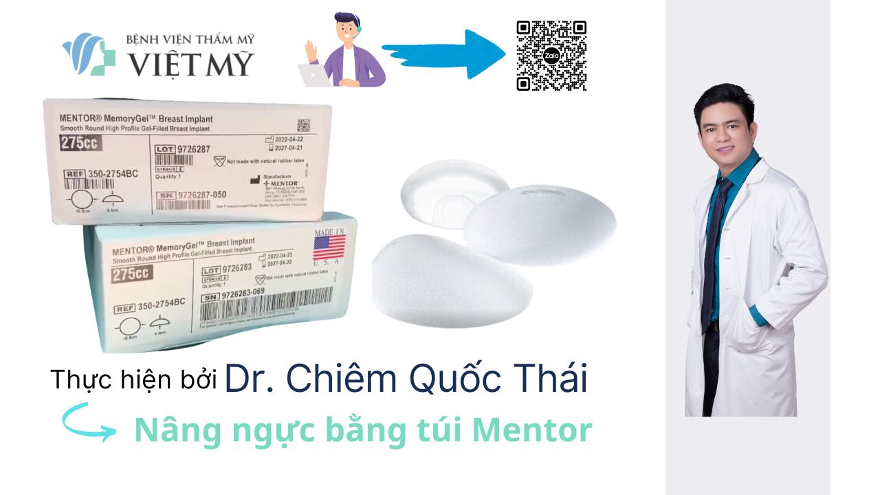 Nang-nguc-Mentor-chinh-hang-bac-si-Chiem-Quoc-Thai.jpg