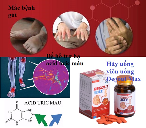 Những sai lầm có thể gặp phải trong quá trình điều trị bệnh gút-2.jpg