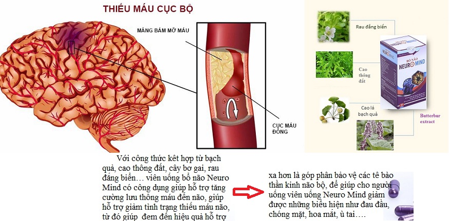 Sự hình thành của cục máu đông bên trong não bộ-2.jpg