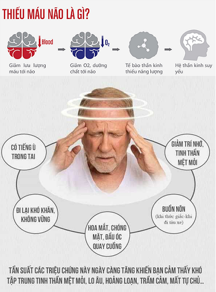 Thiếu máu não gây nên những triệu chứng như chóng mặt, hoa mắt, ù tai và đau đầu-1.png
